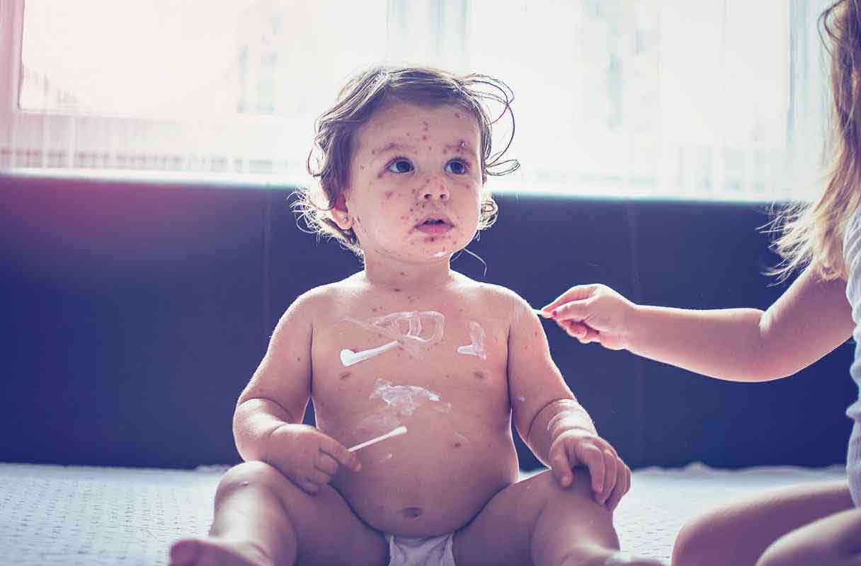 تفاوت سرخجه و سرخک | مرکز خدمات پرستاری پارسیان مهرپرور