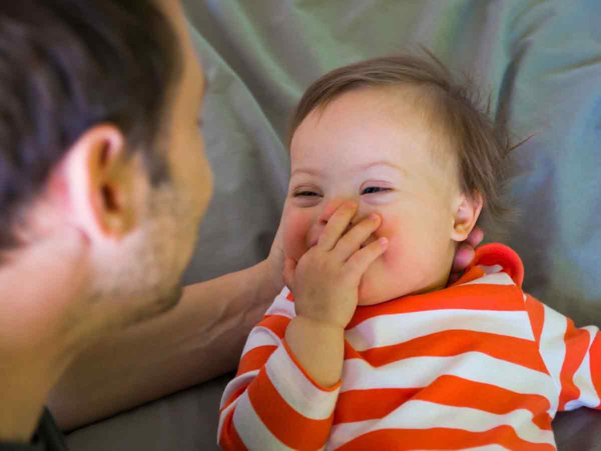 تشخیص سندروم دان | مرکز مهرپرور